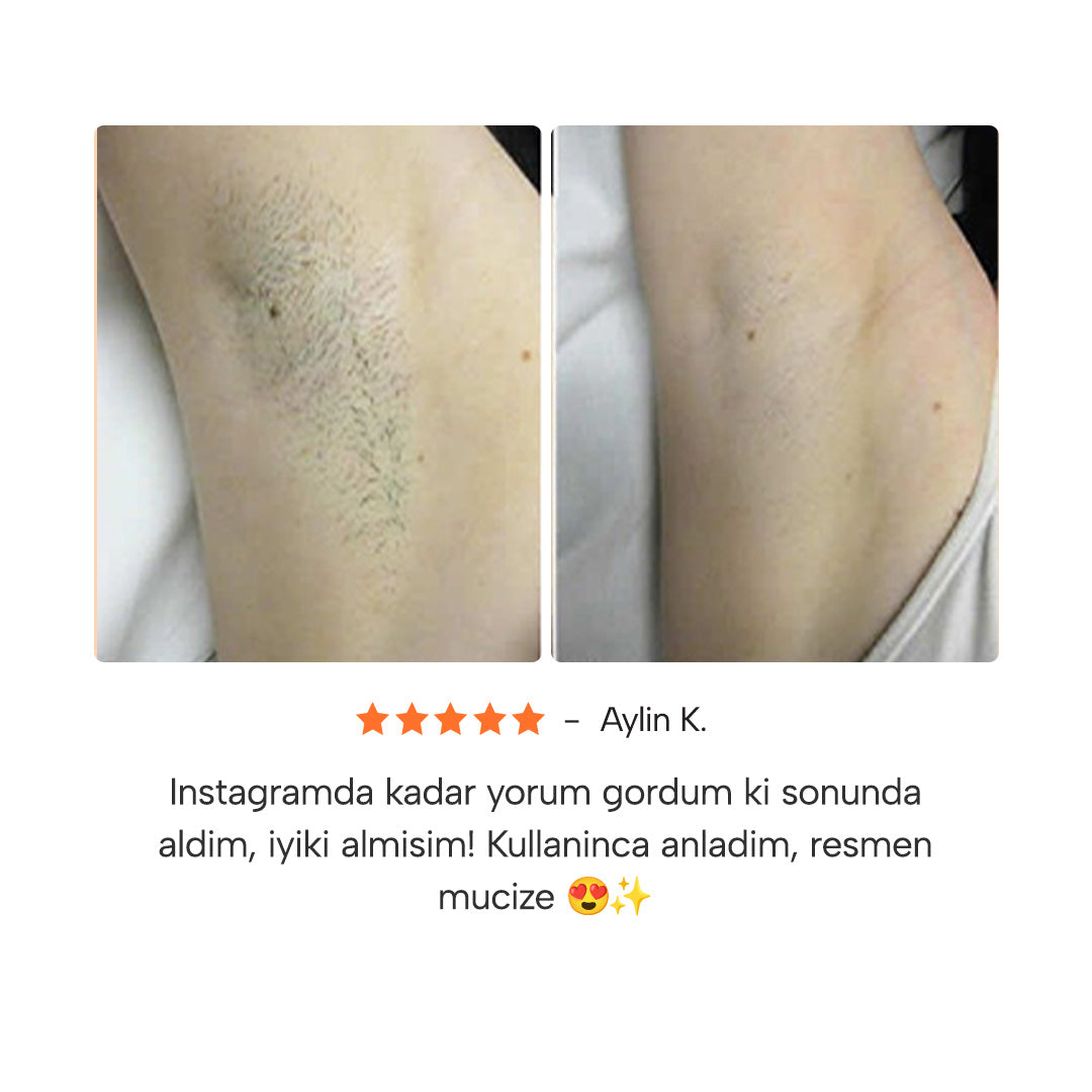 Epify Tüy Dökücü Jel Krem