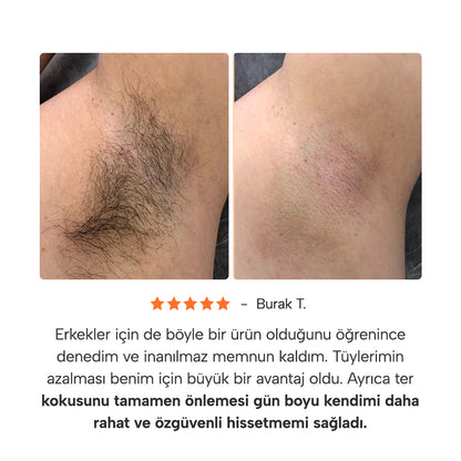 Epify 3 Etkili Koltuk Altı Unisex Roll-On