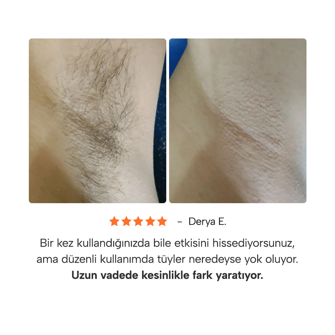 Epify 3 Etkili Koltuk Altı Unisex Roll-On